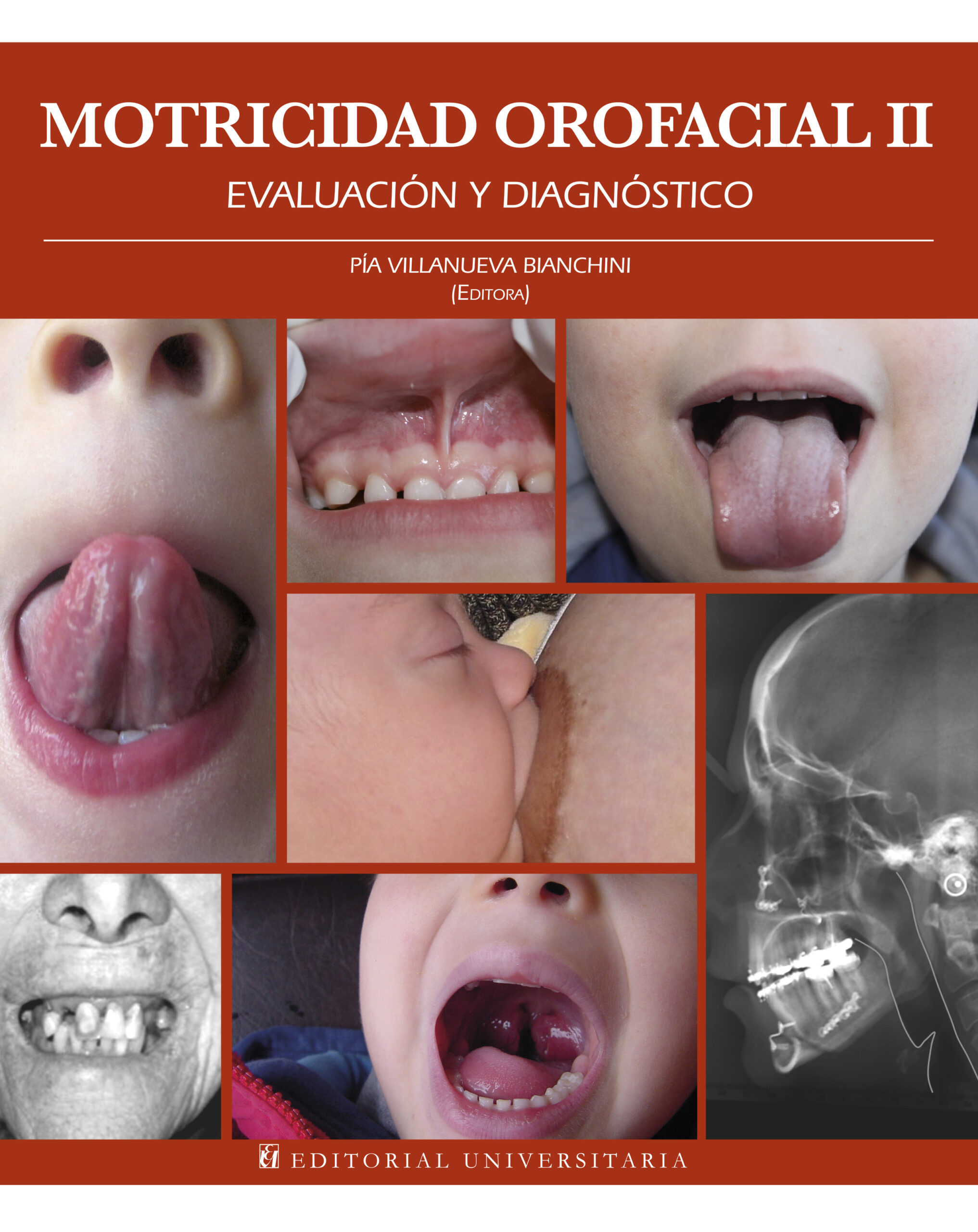 Motricidad Orofacial II. Evaluación y Diagnóstico